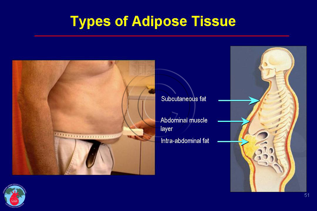 Abdominal Visceral Adipose Tissue Abdominal Visceral Adipose Tissue